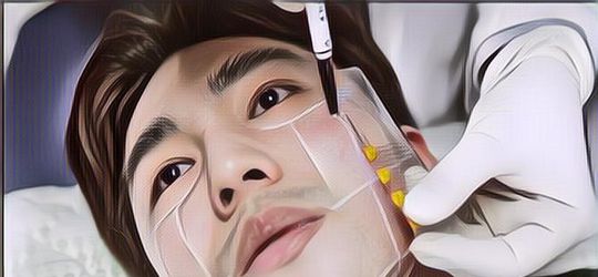 Emang Sih Bikin Cantik dan Ganteng, Tapi Ini Dampak Operasi Plastik yang Harus Diketahui