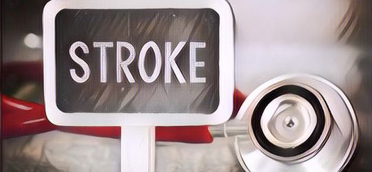 Beda Penanganan, Ini Jenis-jenis Stroke yang Perlu Kamu Ketahui