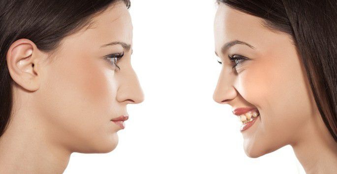 5. Gerakan wajah ekspresif