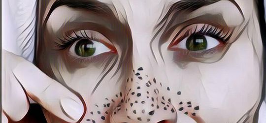 Bagaimana Cara Menghilangkan Komedo yang Irit?