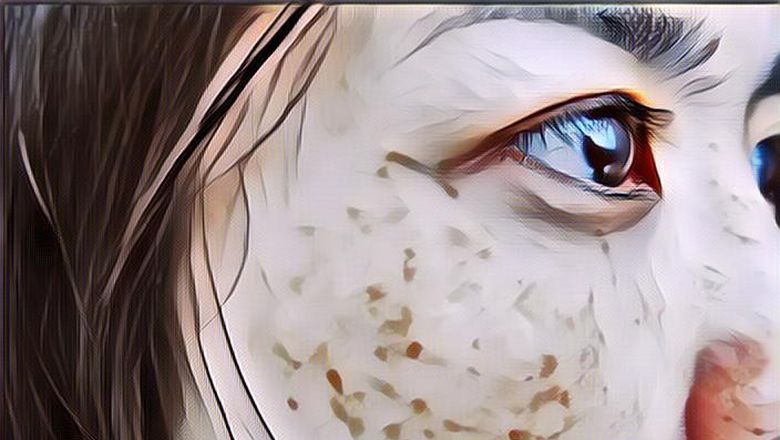 Cara Menghilangkan Flek Hitam Membandel di Wajah, Alami dan Bahannya Gampang Dicari