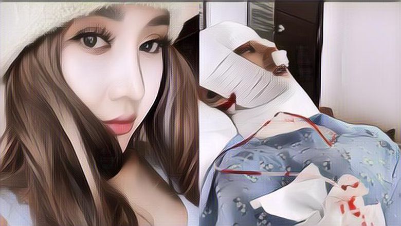 Lakukan Operasi Plastik dan Kini Potong Leher, Dari Mana Lucinta Luna Bisa Punya Uang Banyak? Terungkap Sumber Kekayaannya