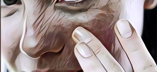 Gak Perlu Biaya Mahal! Ini Dia Tips Menghilangkan Flek Hitam di Wajah dengan Bahan Alami Rumahan