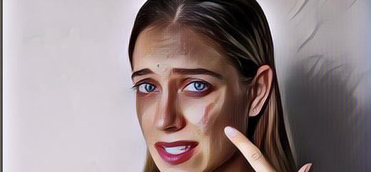 Apa Itu Alergi Kosmetik? Begini Ciri-Ciri dan Cara Mengatasinya