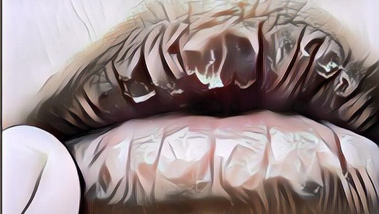 Cara Mengatasi Bibir Kering: Auto Licin Merona dengan Bahan Sederhana Ini