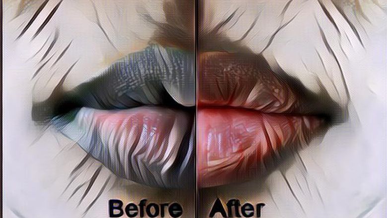 7 Tips Mencerahkan Warna Bibir yang Gelap, Alami dan Terbukti Ampuh!