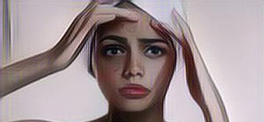 Obat Jerawat Paling Ampuh dan Cepat di Apotik, Bikin Pede!