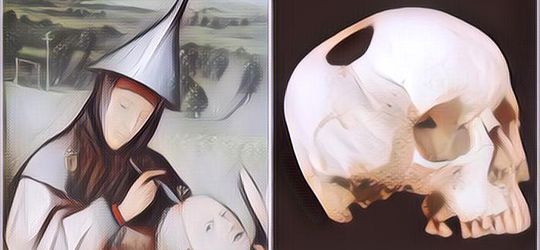 Deretan Teknik Pengobatan Menyeramkan yang Masih Dipakai Hingga Saat Ini