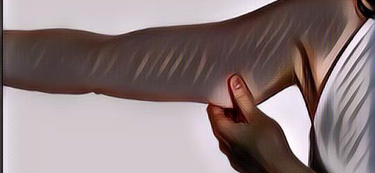 Lengan Sebelah Kiri Kedutan? Siap-siap Bakal Ketiban Rezeki Nomplok