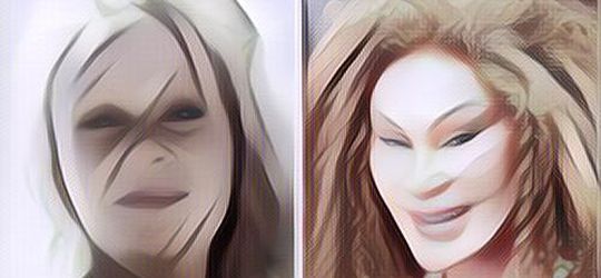 Deretan Wajah Artis yang Makin Aneh Karena Ketagihan Operasi Plastik