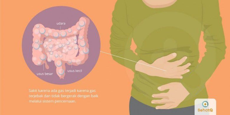# Beberapa Gerakan Mengatasi Perut Kembung