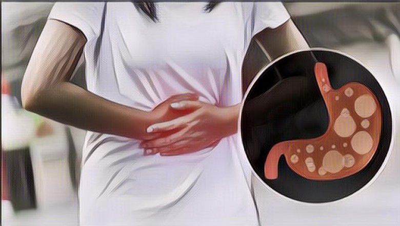 6 Tips Puasa Untuk Penderita Asam Lambung, Ternyata Cara Makan Kita Berpengaruh Besar Loh!