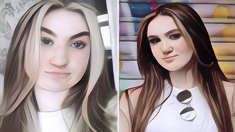 Wanita Ini Rela Rogoh Kocek Rp 150 Juta Untuk Oplas Hidung Karena Malu Saat Kencan