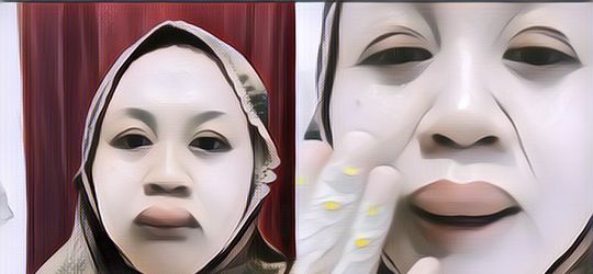 Viral Wanita Bibirnya Mendadak Bengkak 3 Jam Sebelum Akad Nikah! Begini Kondisinya