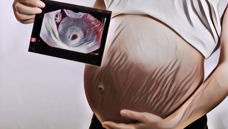 Setelah 5 Tahun Menanti, Wanita Ini Beri Surprise ke Suami Foto USG Kehamilan: Jadi Kado Terindah