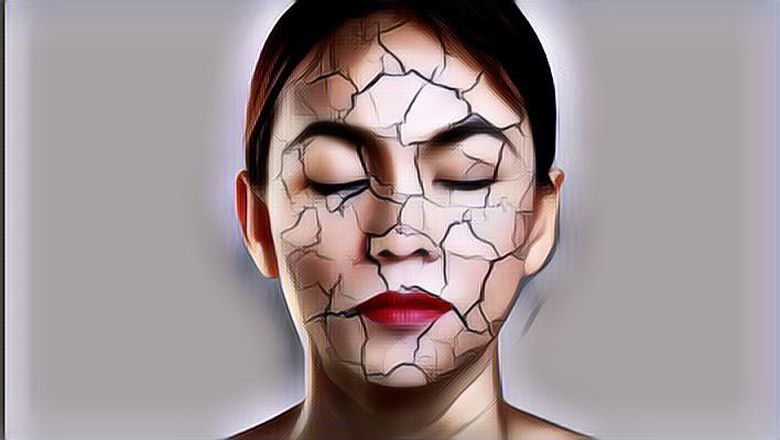 Perawatan untuk Kulit Wajah yang Super Kering