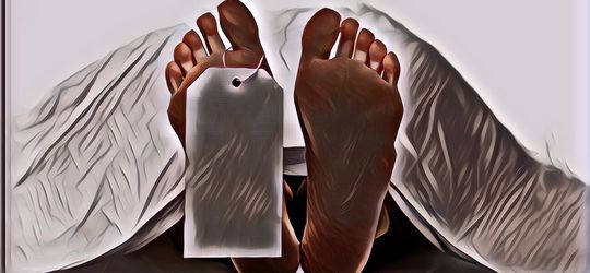 Aneh bin Ajaib, Mayat Pria Ini Tiba-tiba Bangun Saat Hendak Diotopsi Para Dokter!