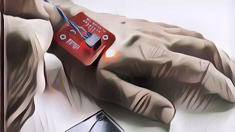 Ngiluu! Pria Ini Tanam Chip di Kedua Tangannya, OMG Untuk Apa Sih?