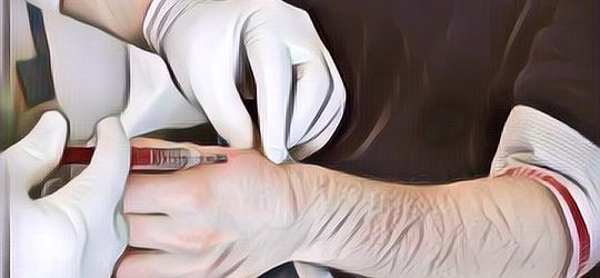 Kisah Pria yang Tanam Chip di Kedua Tangannya, Apa Fungsinya?