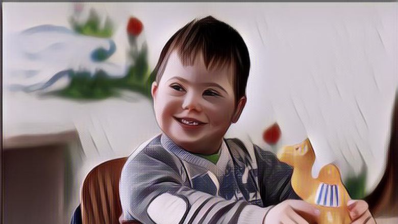 Psikologi Anak Berkebutuhan Khusus, Perlu Perlakuan yang Beda