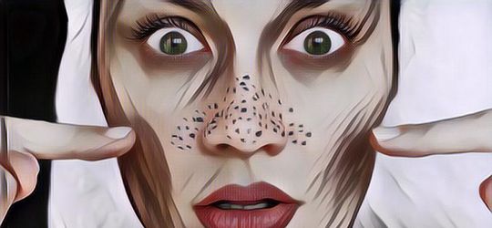 Cara Mencegah Munculnya Komedo, Gak Perlu Perawatan Mahal-Mahal Kok!