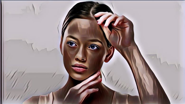 5 Perawatan Kulit untuk Remaja yang Bisa Mengatasi Jerawat