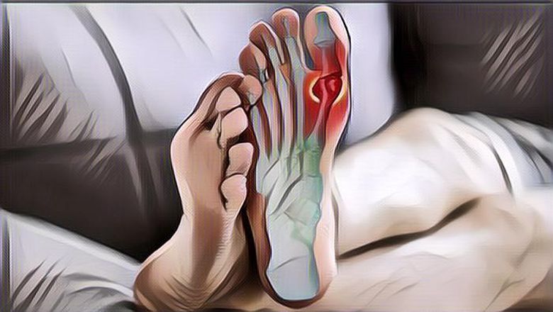 Kenali Beragam Bahan Alami untuk Menurunkan Asam Urat