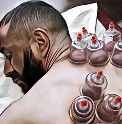 8 Manfaat Terapi Bekam yang Mungkin Belum Kamu Tahu