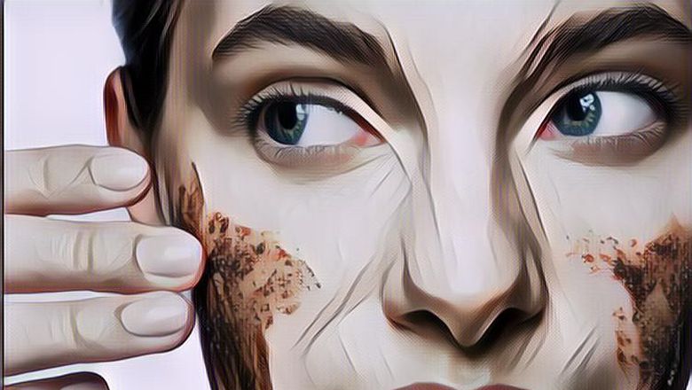 Tiga Tips Mudah Atasi Kulit Kering di Musim Hujan, Wanita Wajib Tau Ini