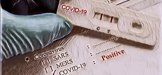 Dua Meninggal, Ratusan Karyawan PT HM Sampoerna Surabaya Positif Rapid Tes COVID-19