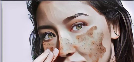 Merawat Kulit Kering dan Kusam Agar Lebih Kinclong