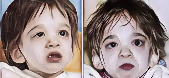 Kisah Brooke Greenberg, Gadis 20 Tahun yang Terjebak Dalam Tubuh Bayi 2 Tahun