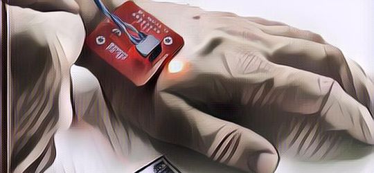 Ngiluu! Pria Ini Tanam Chip di Kedua Tangannya, OMG Untuk Apa Sih?