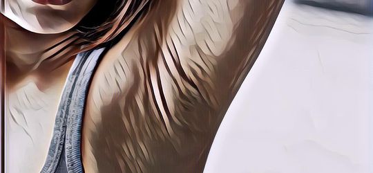 Penyebab dan Tips Membersihkan Ketiak Hitam