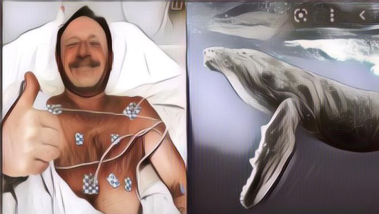 Hidupnya Persis Seperti Nabi Yunus, Pria Ini Pernah Ditelan Paus dan Tetap Selamat