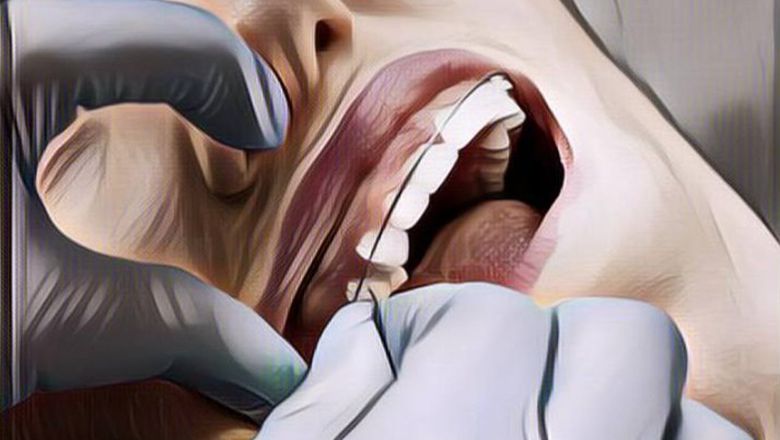 Heboh! Balita Ini Sudah Pakai Behel Sejak Kecil, Warganet Singgung Bahayanya