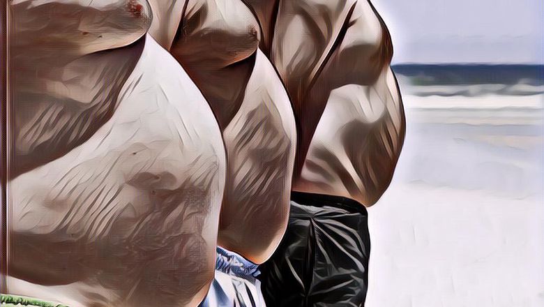 Ini Penyebab Orang Amerika Obesitas, Ternyata Bukan karena Makanan