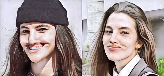 Bibirnya Lepas Digigit Anjing, Gini Penampilan Terbaru Model Cantik Ini Usai Jalani Oplas Rp6 M