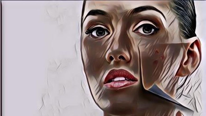 Cara Menghilangkan Bekas Jerawat dan Bintik Hitam, ASAP!