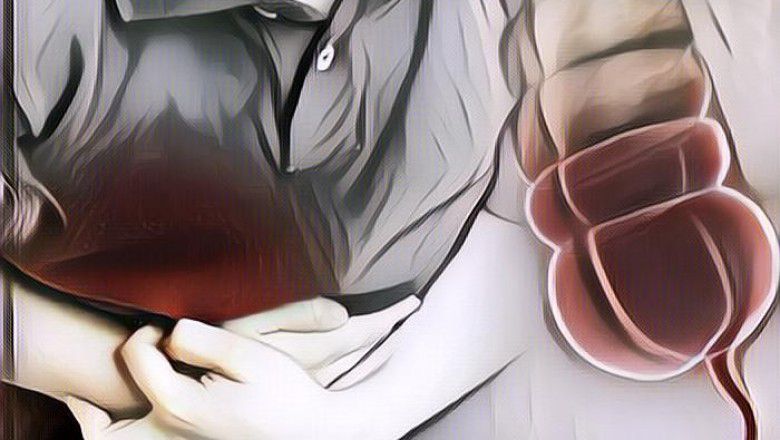 Gejala Usus Buntu, Waspada Penyakit yang Tak Disadari Serangannya