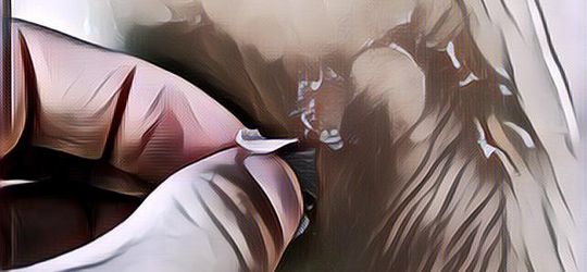 Jangan Lakukan 5 Hal Ini Saat Kulit Mengalami Sunburn, Bisa Bikin Kulit Makin Tipis!